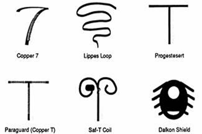 [DIAGRAM] Copper Iud Diagram - MYDIAGRAM.ONLINE