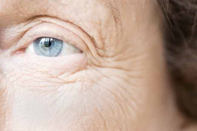 See How Your Life Affects Your Skin In Hindi त वच क प रभ व त कर सकत ह आपक ल इफस ट इल