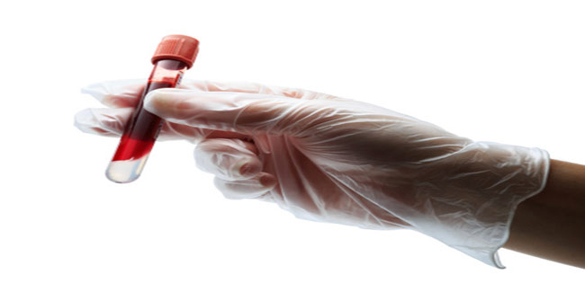 What must one expect before Blood Tests?