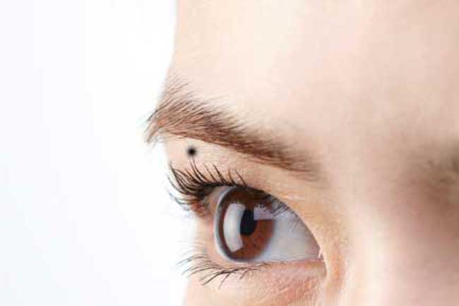 mole-above-left-eye-decode-the-secrets-of-moles-on-your-body