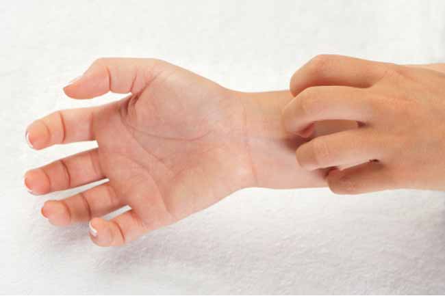 Itchy Hands and Feet: Causes and Treatments