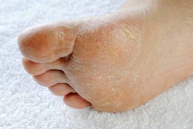 Itchy Hands and Feet: Causes and Treatments