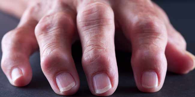 Protecting Kidneys from the Wrath of Rheumatoid Arthritis