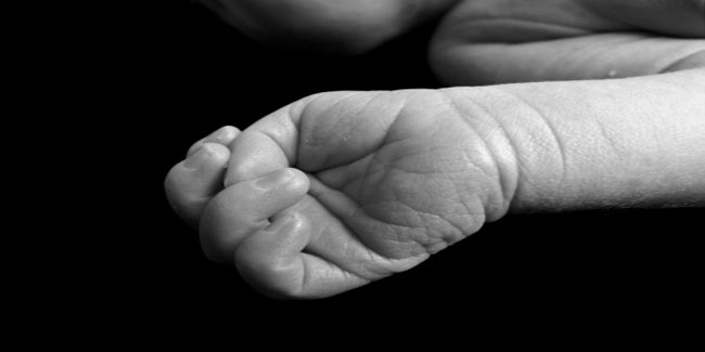 What are the symptoms of Harlequin ichthyosis?