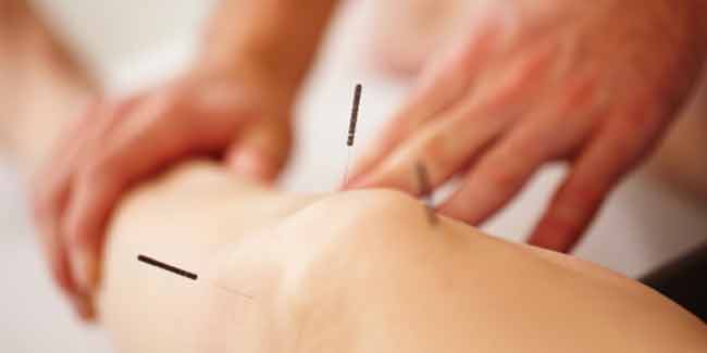 Acupuncture May not be Easing your Knee Pain