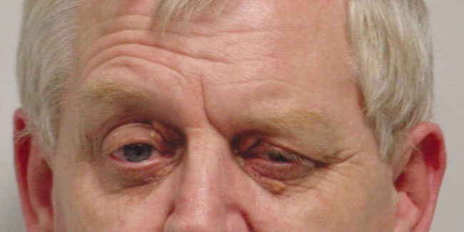 What is Hemifacial Spasm