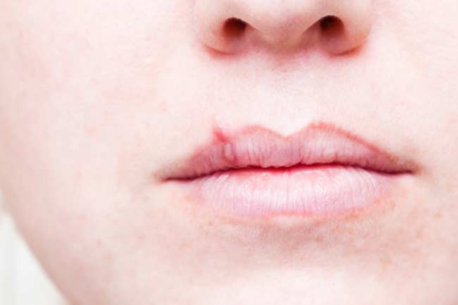 7-amazing-benefits-of-using-glycerine-on-your-lips