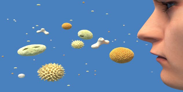 allergic rhinitis