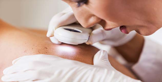 skin cancer in hindi 