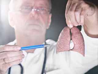 Tuberculosis during Pregnancy: Everything you Wanted to Know