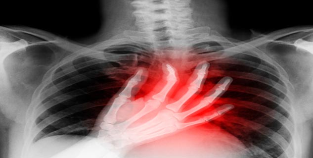 हृदय कैंसर Heart Cancer in Hindi