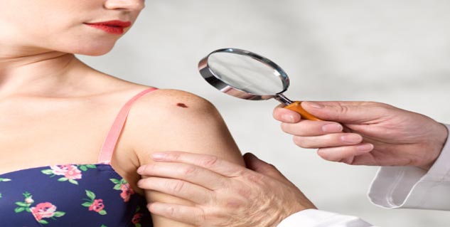 Skin Cancer in Hindi