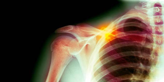 shoulder bone cancer in hindi