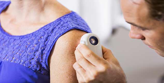 skin cancer in hindi 
