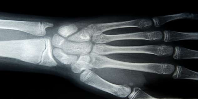 bone cancer in hindi 