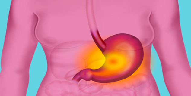 heartburn In Hindi
