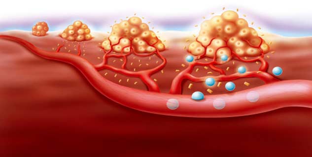 blood cancer in Hindi 
