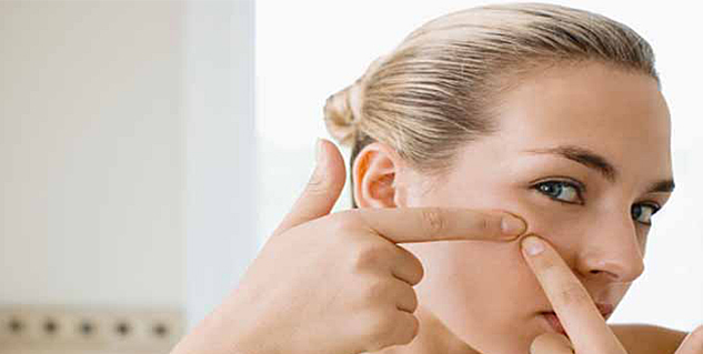Exercises Cause Acne in Hindi