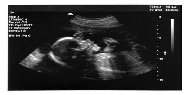 pregnancy in hindi 