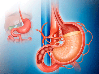 एसीडिटी की दवा से कहीं आपकी किडनी तो नहीं हो रही खराब 