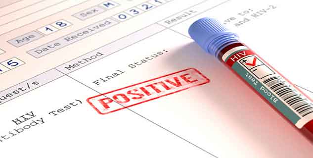 HIV treatment in hindi 