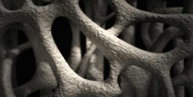 osteoporosis in hindi 