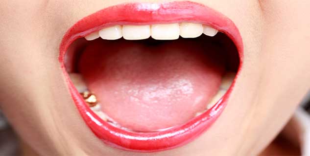 How does tooth cap work