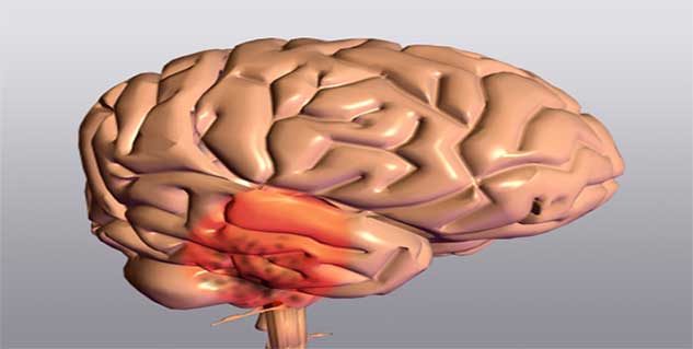 Parkinson's disease in hindi 