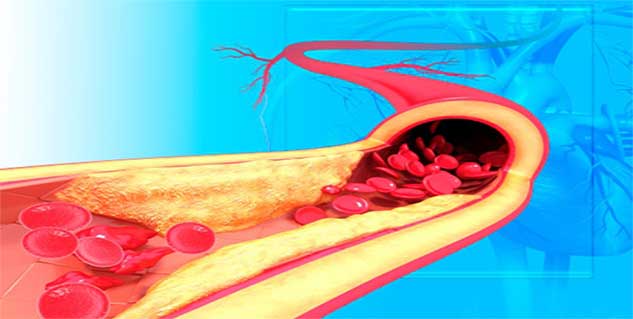 heart disease treatment in hindi 