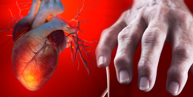 heart and arthritis in hindi 