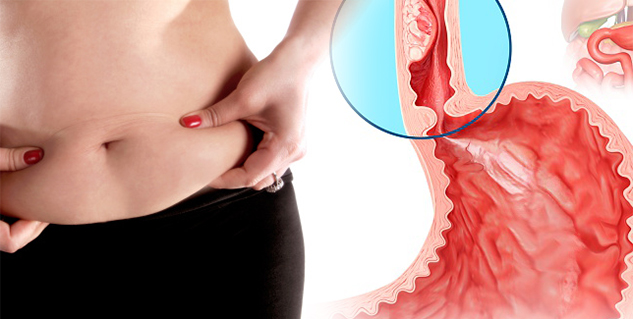 obesity and oesophageal cancer in hindi