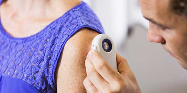 New technology developed for skin cancer screening