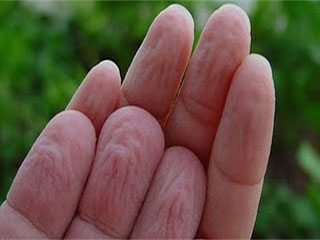 पानी में अधिक देर तक डालने से क्‍यों सिकुड़ जाती हैं उंगलियां 