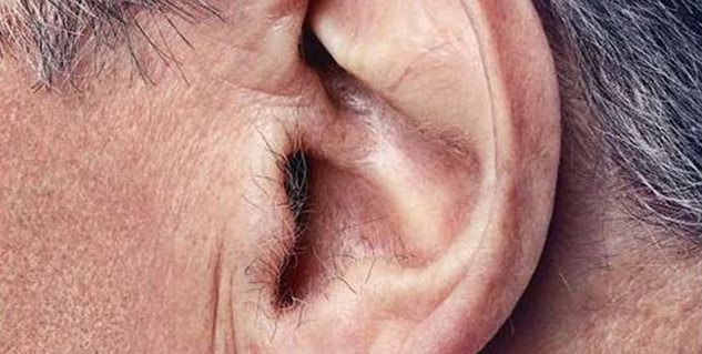 hair on ear in hindi 