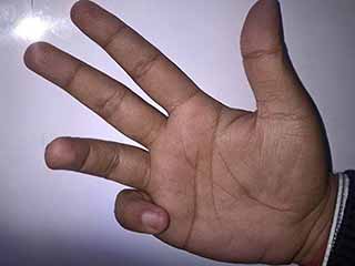 रज मुद्रा करने के तरीके और फायदों के बारे में जानें