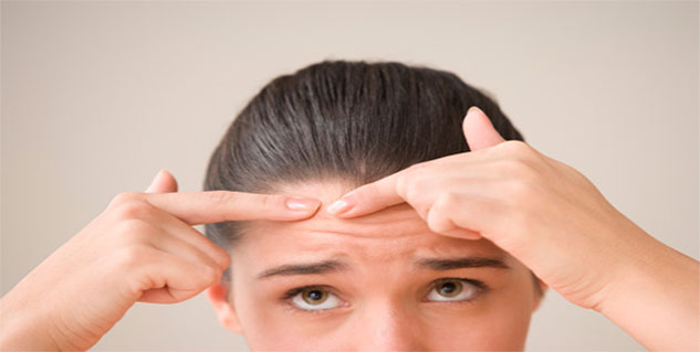 Acne in Hindi