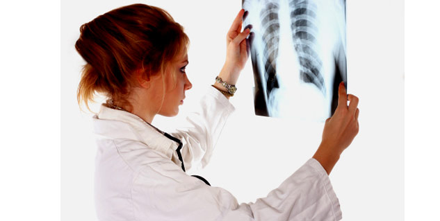 lung cancer