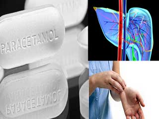 डॉक्‍टर की सलाह के बिना पैरासीटामॉल लेने से हो सकती हैं ये 5 बीमारियां 