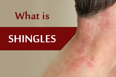 Symptoms and treatment options for shingles