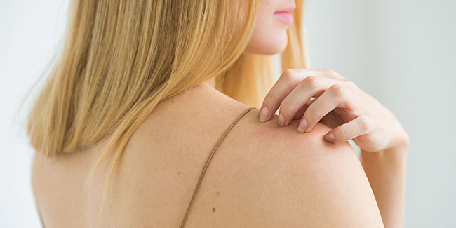 Attention ! These foods may cause psoriasis
