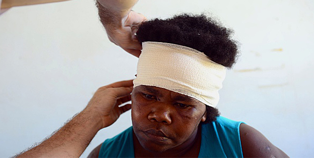 head injury