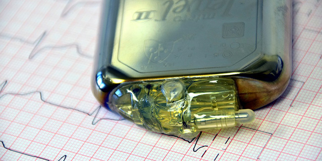 How do pacemakers work?
