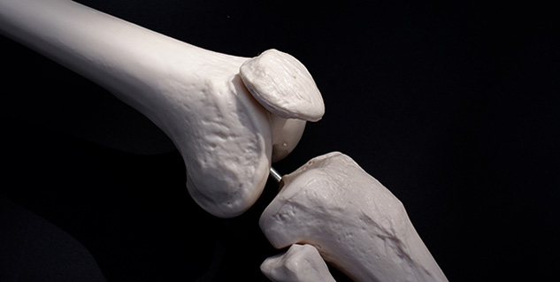 bones