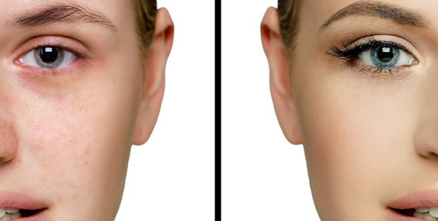 pigmentation in hindi 