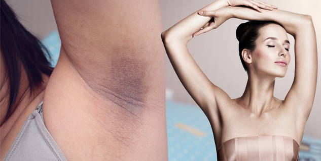 underarms
