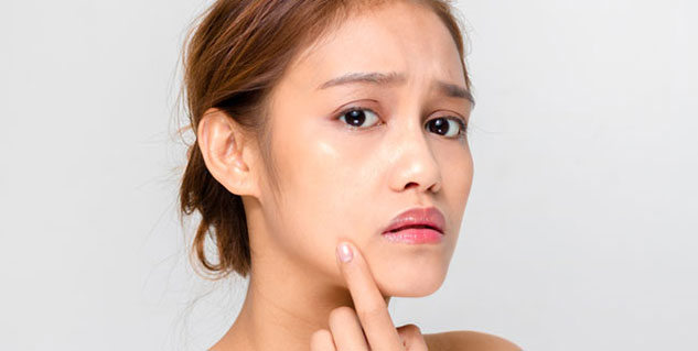 pimples in hindi 