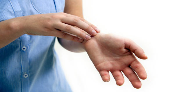 eczema