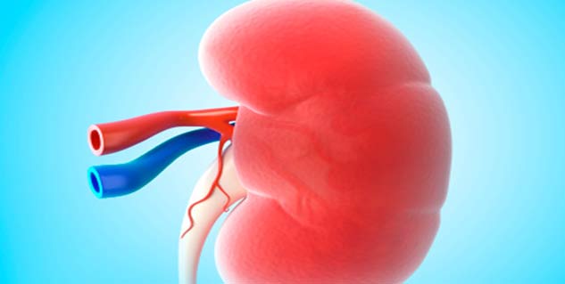 kidney stone