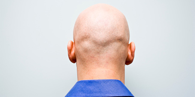 Home remedies for hair loss in men