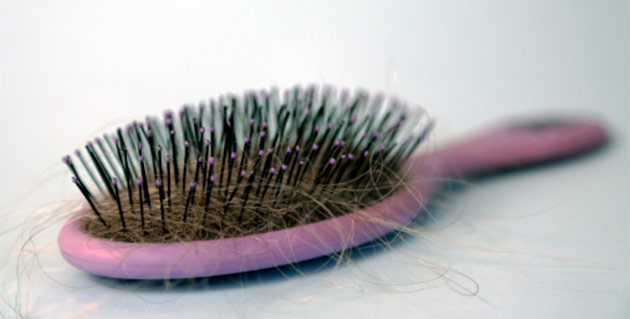 hair loss in hindi 
